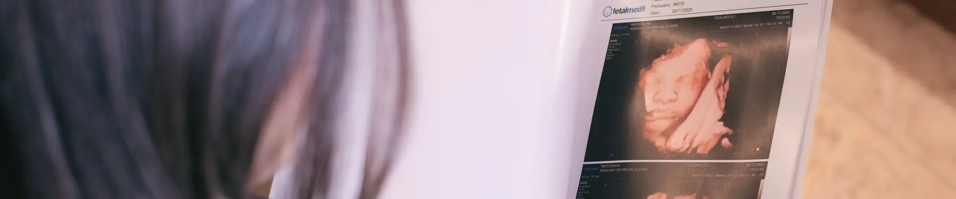 Exames de medicina fetal e ultrassonografia obstétrica realizados na Fetalmed