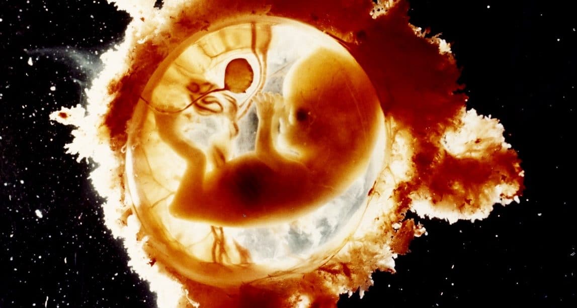 Embrião de 10 semanas