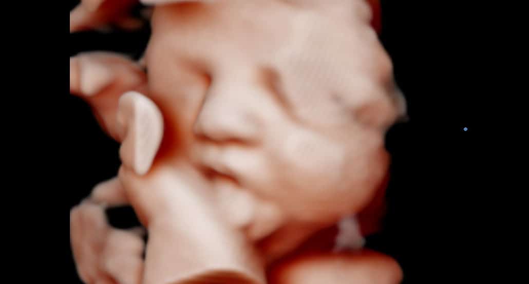 Ultrassom 3D face Fetal