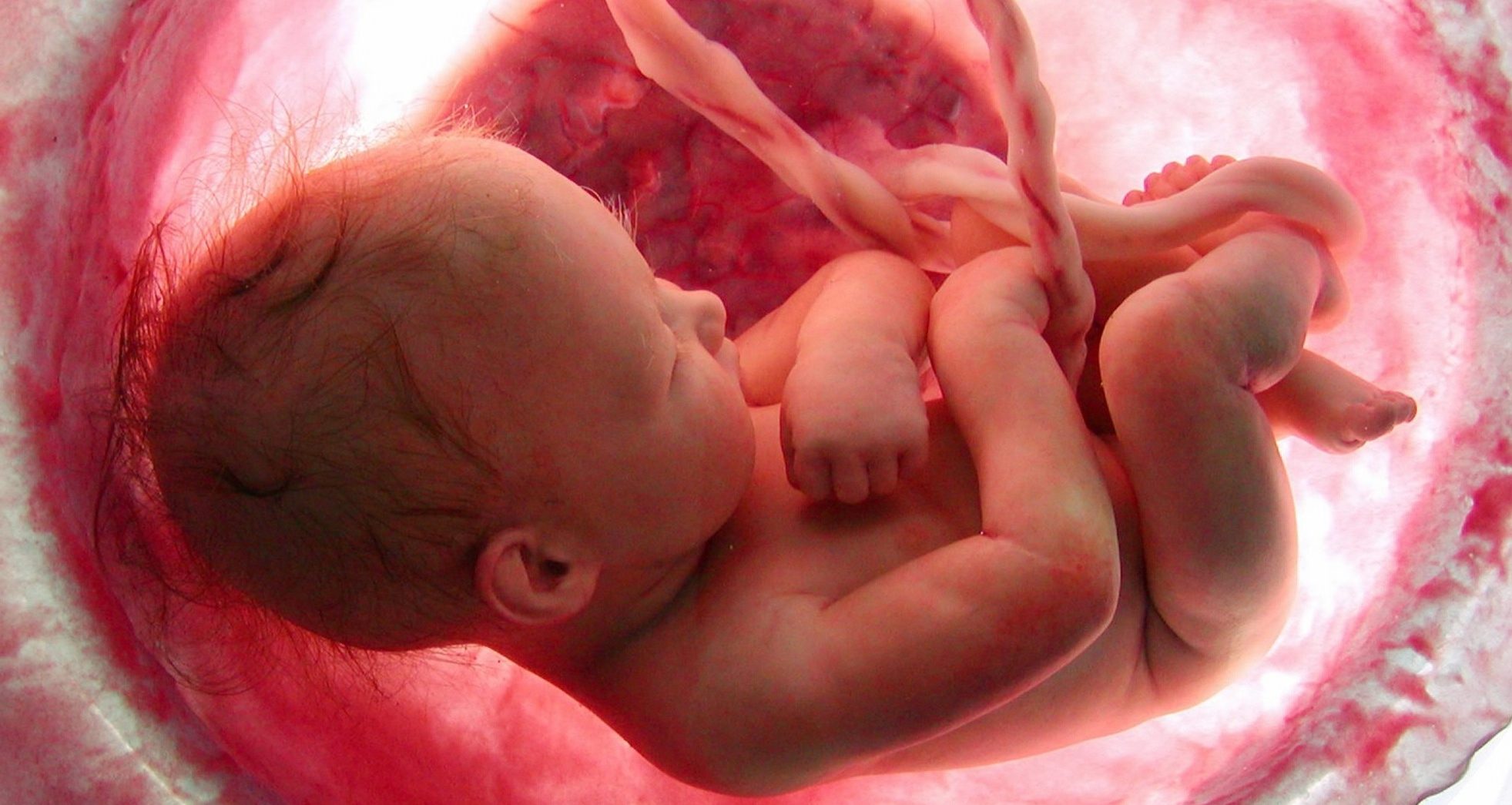 Imagem feto dentro do útero