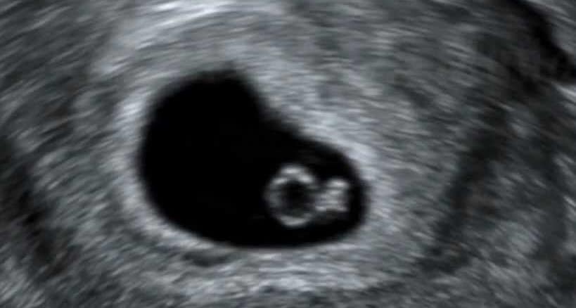 Embrião de 5 semanas