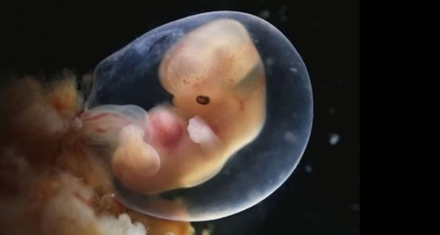 Embrião de 8 semanas