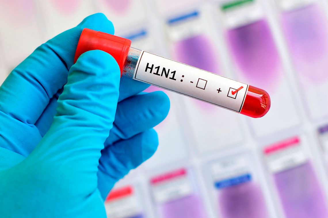 Exame de Sangue h1n1