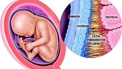 Fibronectina Fetal