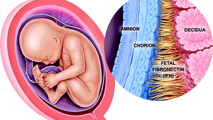 Teste da Fibronectina Fetal