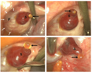 Ovulação Laparoscopia