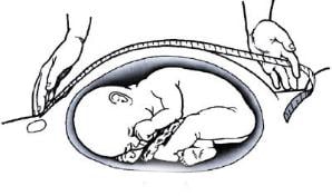 medida da altura uterina para diagnosticar restrição de crescimento intra-uterino