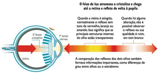 teste-do-olhinho1