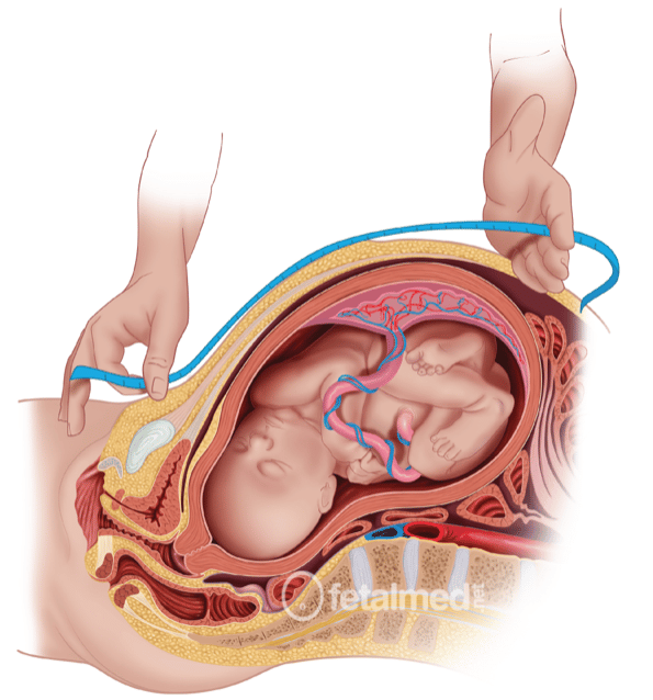 Mulher Grávida a Medir a Barriga Com Fita Métrica Imagem de Stock - Imagem  de tamanho, nascimento: 157720491