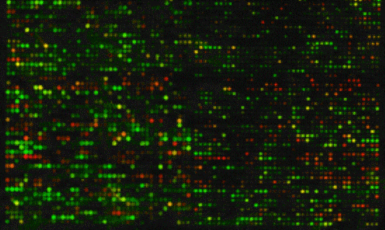 O uso do Microarranjo de DNA em Medicina Fetal