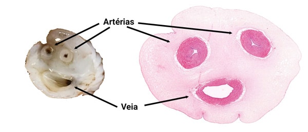 Cordão Umbilical Normal