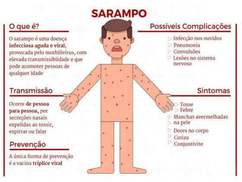 Infograma Sarampo