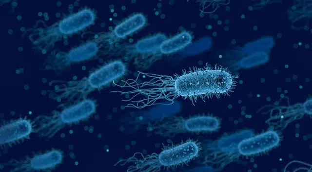 Evidências de que infecções intra-amnióticas são frequentemente o resultado de uma infecção ascendente – um estudo microbiológico molecular