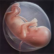 no amniotic fluid no amniotic fluid