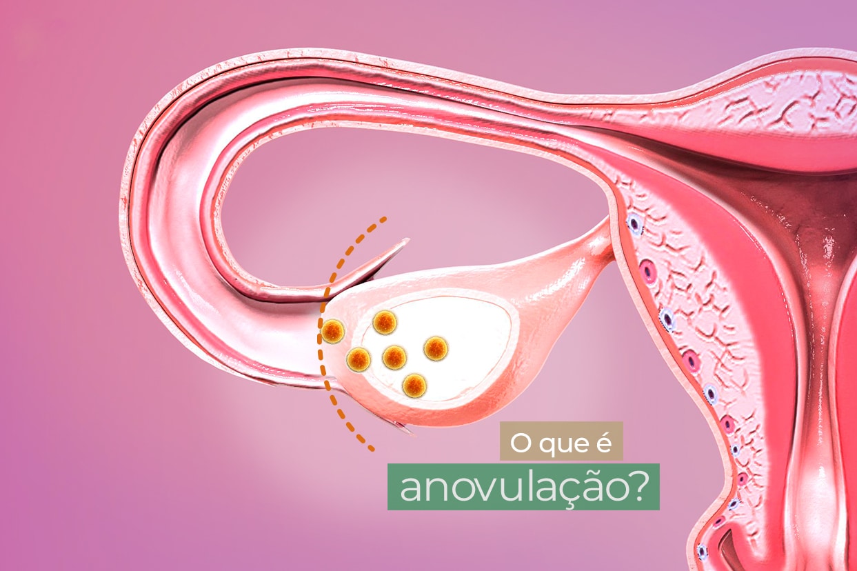 Causas comuns da falta de menstruação