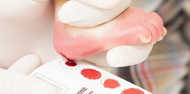 O que você precisa saber sobre o Teste do Pezinho? | Fetalmed