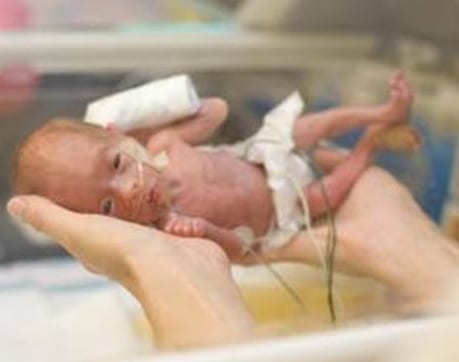 Bebê com Restrição de Crescimento Intra-Uterino