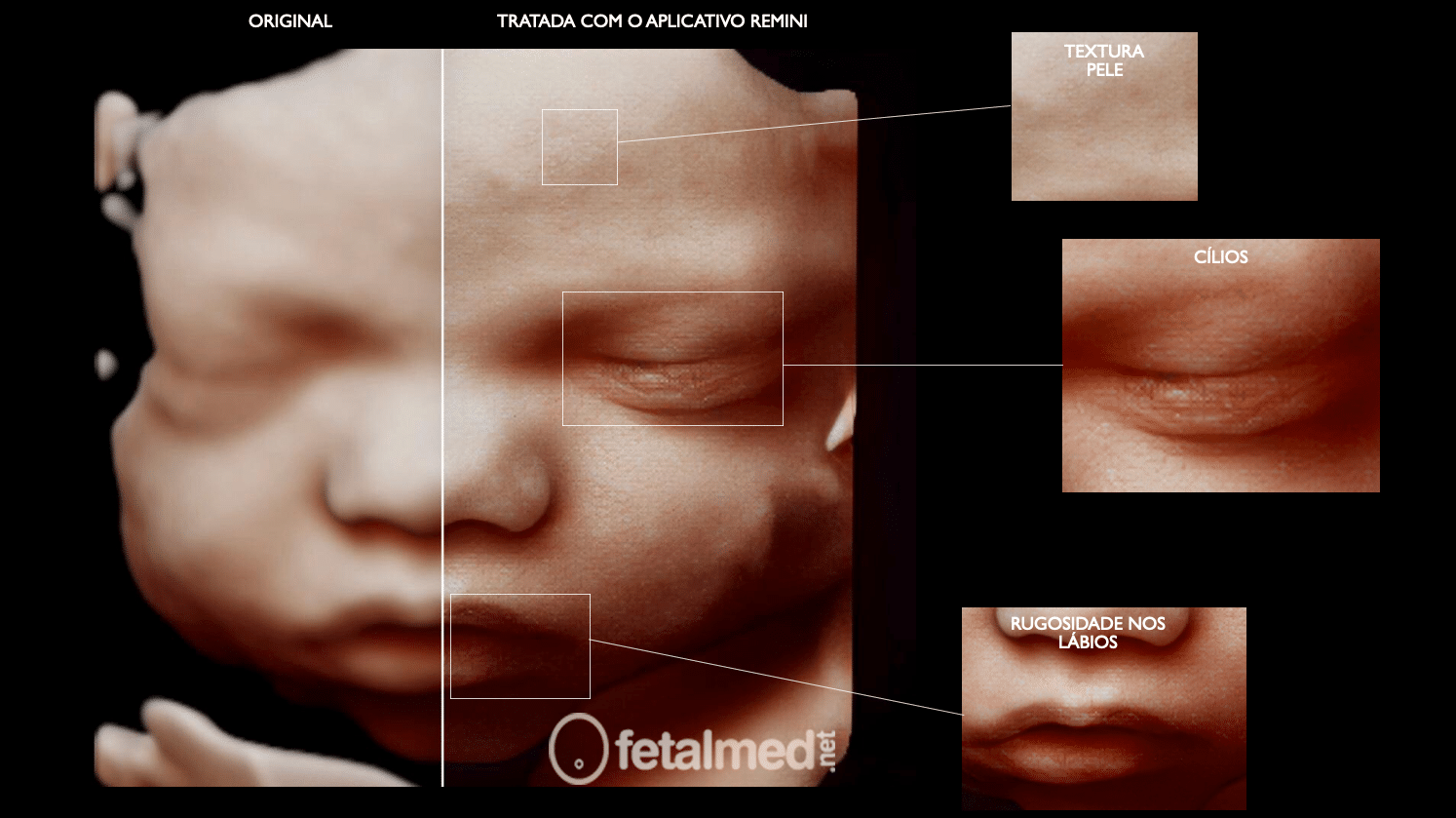 Alterações Realizadas Pelo Aplicativo Remini