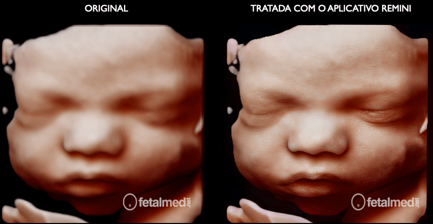 Imagem 3D Original e Tratada com Remini, podemos observar a significante Melhora Imagem 3D