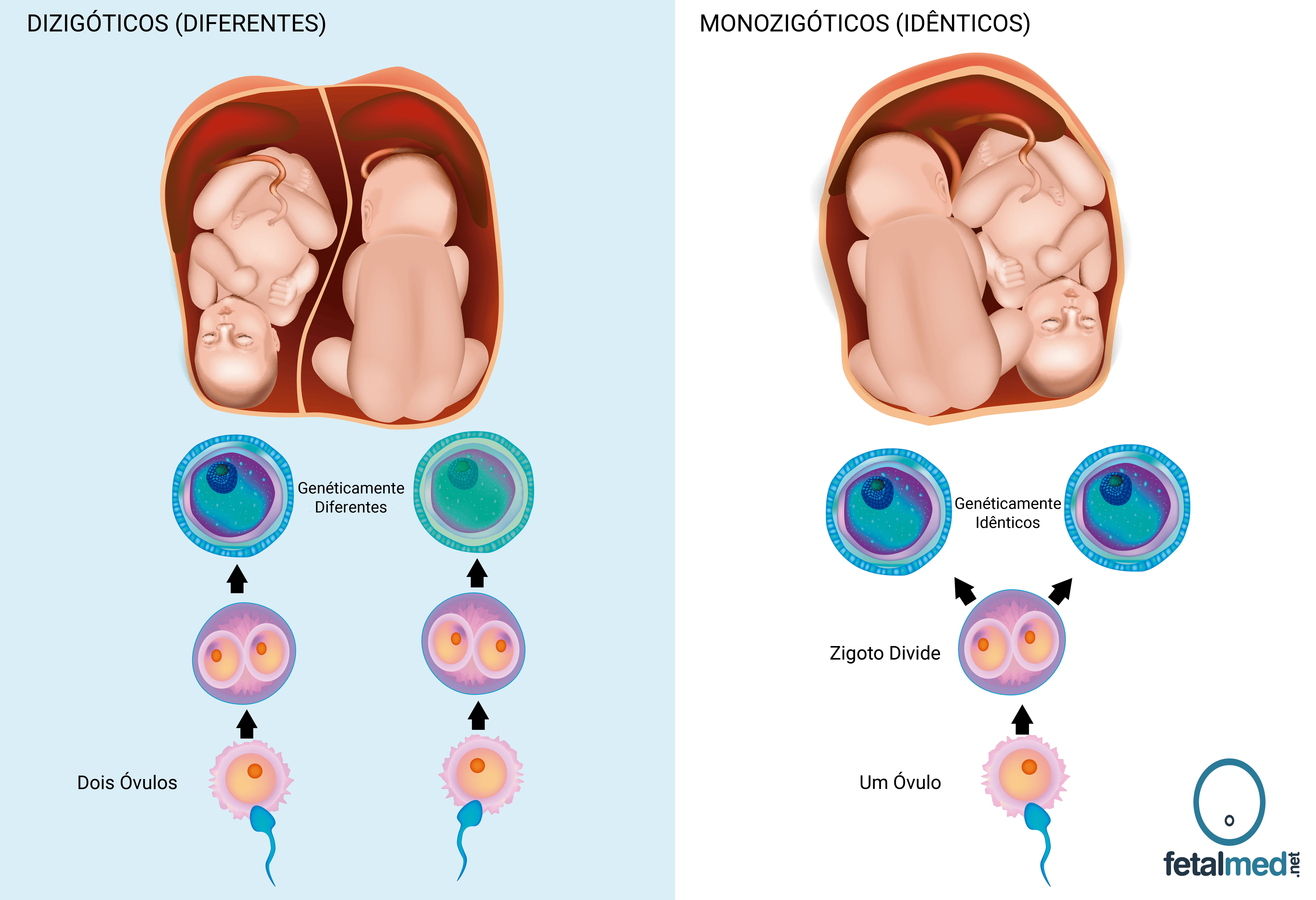 Gêmeos Diferentes Vs Idênticos