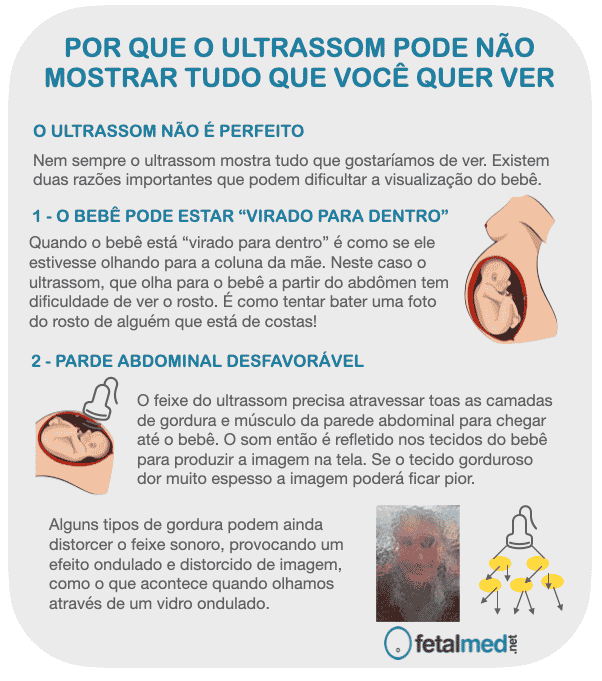 Você faz alguma ideia do que seja sexagem fetal?