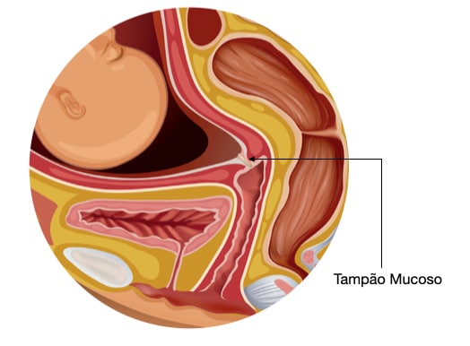 Tampão Mucoso