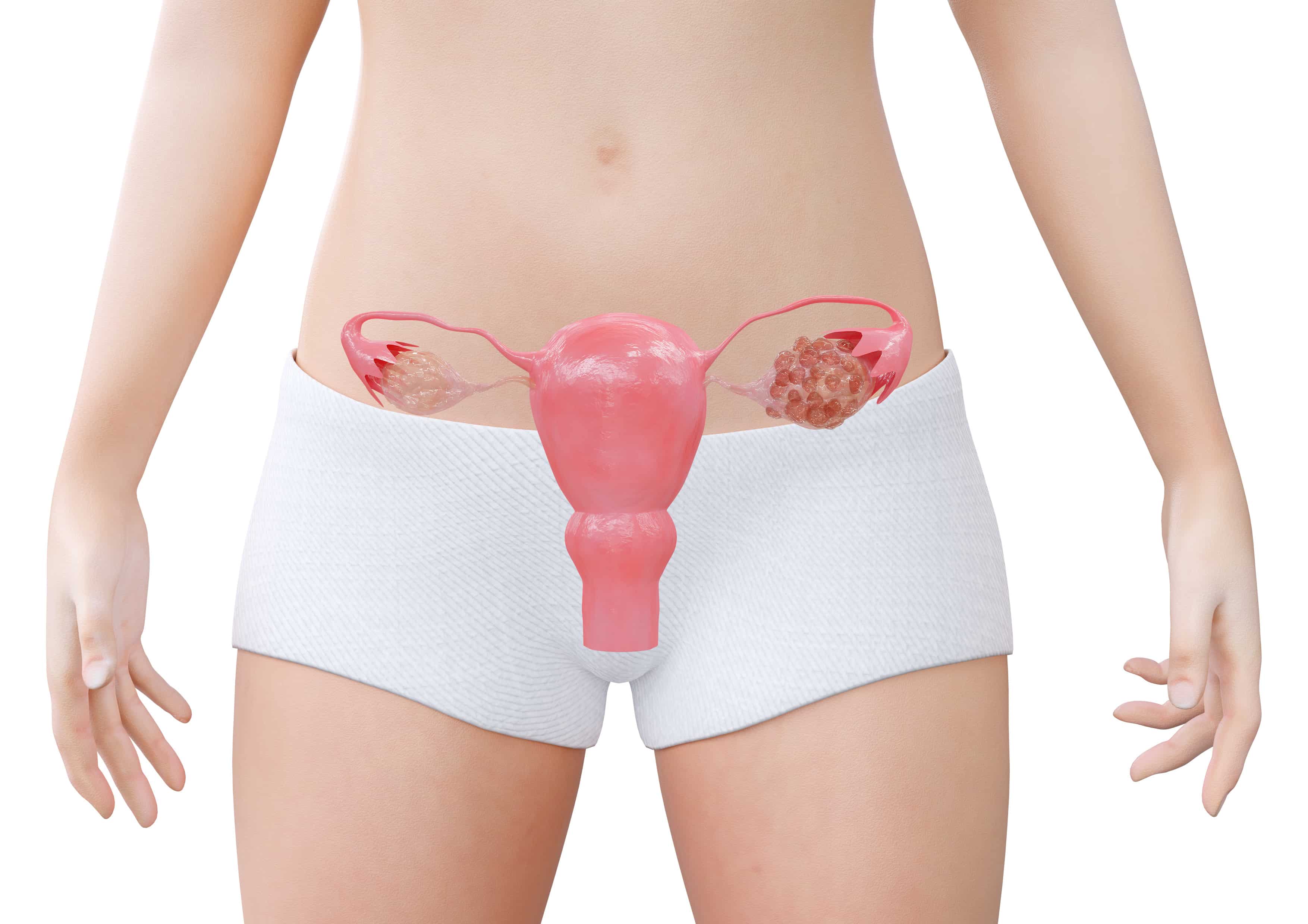 Menstruação desregulada: o que pode ser?
