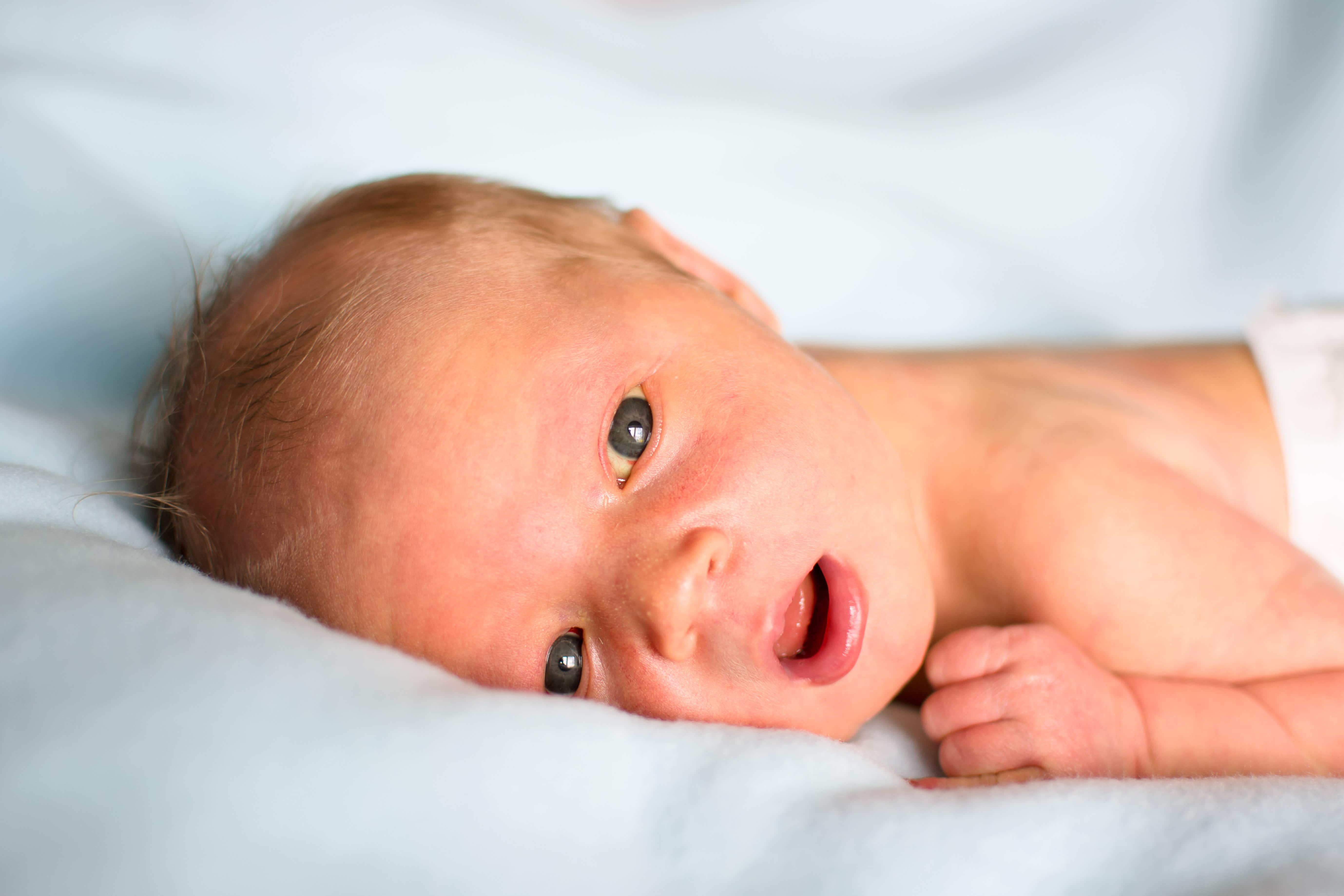 O Amarelinho do Bebê: Desvendando a Icterícia Neonatal