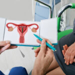 Gravidez com DIU: Mitos e Verdades…