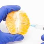 A Verdade sobre Ninfoplastia: Benefícios e…