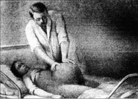 Técnica Manobra de Kristeler