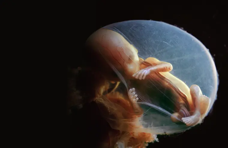 Feto de 15 semanas - 15a semana de gravidez | Fetalmed