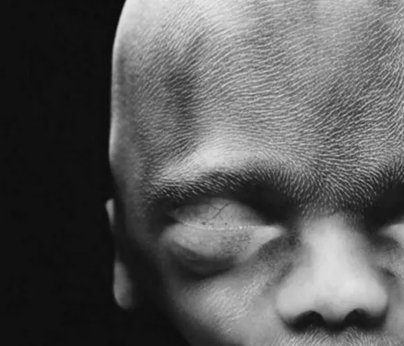 Feto de 17 Semanas - 17a semana de gravidez | Fetalmed