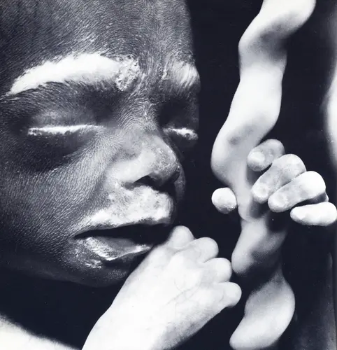 Feto de 18 Semanas - 18a semana de gravidez | Fetalmed