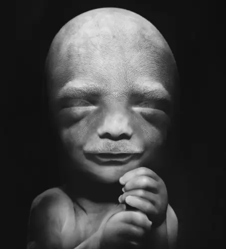 Feto de 19 Semanas - 19a semana de gravidez | Fetalmed