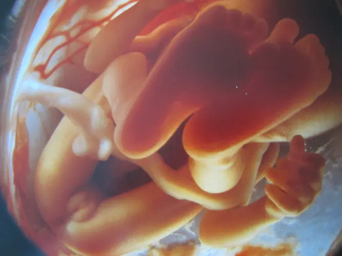 Feto de 25 semanas - 25a semana de gravidez | Fetalmed