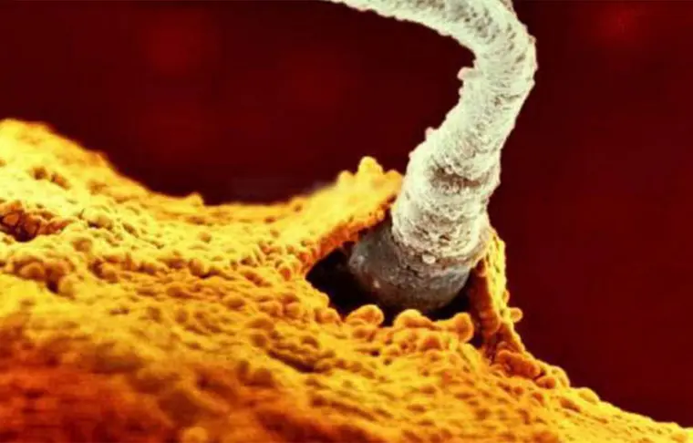 Espermatozóide Fecundando o Óvulo - 3a semana de gravidez | Fetalmed