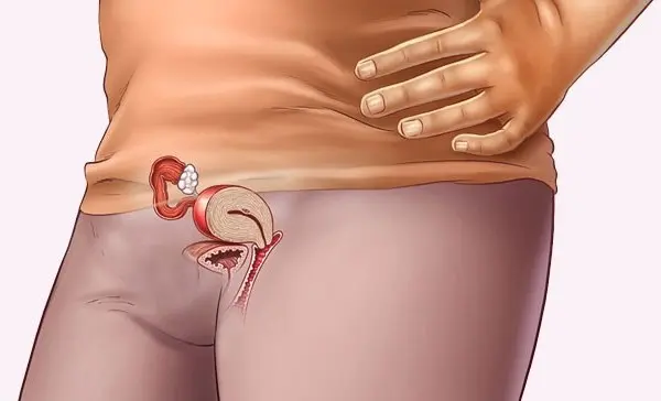 4 semana de gravidez - 4a semana de gravidez | Fetalmed