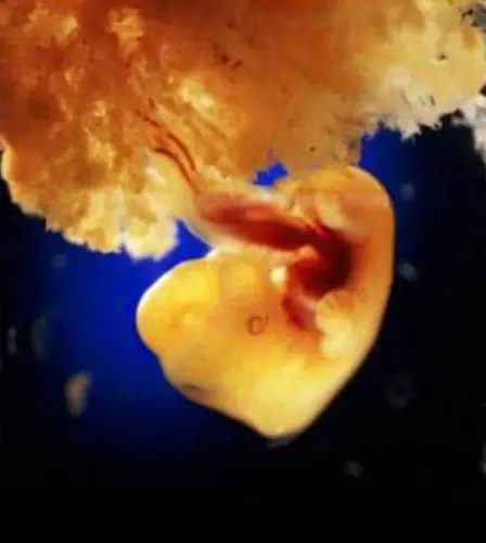 Embrião de 7 semanas - 7a semana de gravidez | Fetalmed