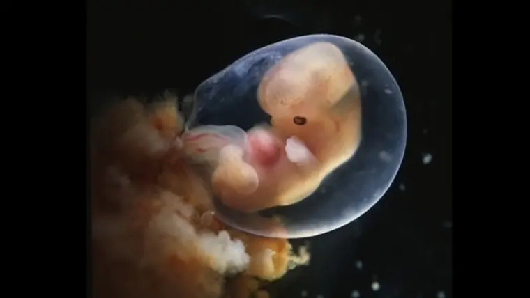 Embrião de 8 semanas - 8a semana de gravidez | Fetalmed