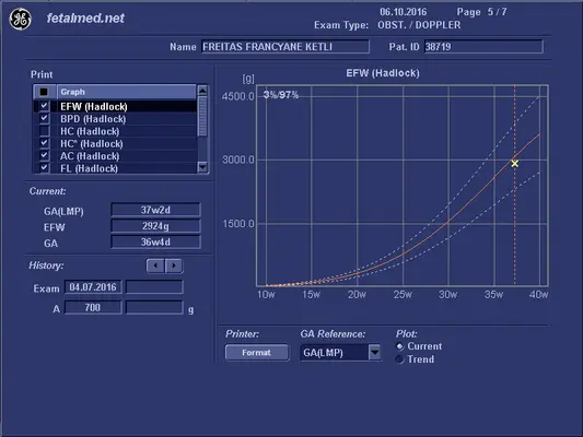 Tabela de peso fetal estimado segundo Hadlock 1991